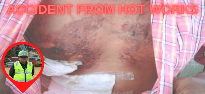 Accident from Hot Works